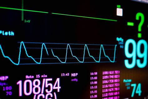 A Guide To The Perfusion Index In Pulse Oximeters – LOOKEETech