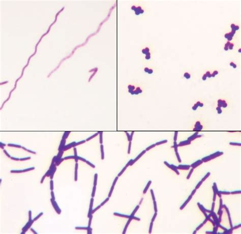 Mixed bacteria, bacillus, cocci and spirillum, separate smear, Gram ...