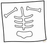 X Ray coloring Page  Free Printable Coloring Pages sketch template