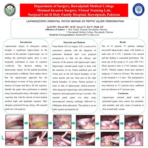 Laparoscopic Omental Patch Repair of Peptic Ulcer Perforation - SAGES Abstract Archives