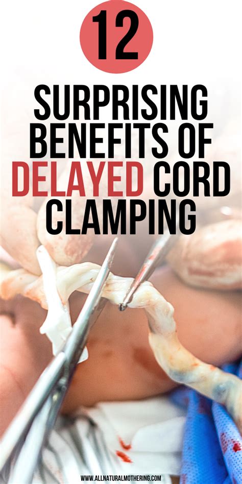 Delayed cord clamping – Artofit