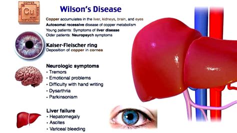 Wilsons Disease Skin