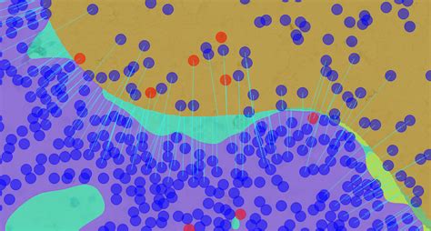 Faron Pharmaceuticals utilizes AI to perform spatial analysis in cancer drug development