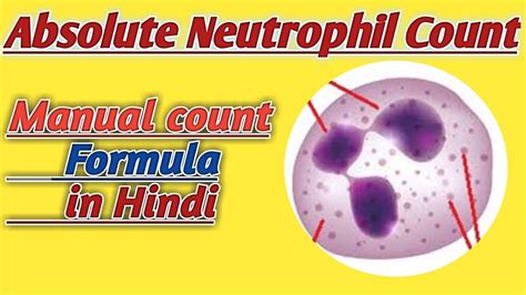 Abs Neutrophils High Symptoms at Robert Hatch blog