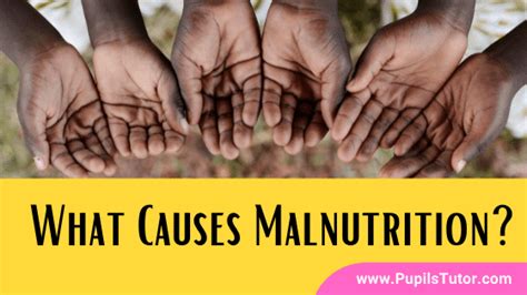 What Causes Malnutrition?