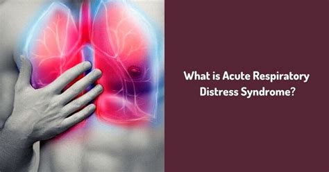 What is Acute Respiratory Distress Syndrome?