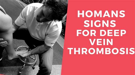 Homans Sign for Deep Vein Thrombosis - YouTube