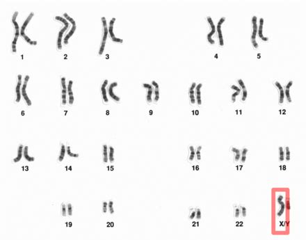 X chromosome - Wikipedia