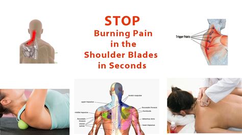 Stop Burning Pain in Shoulder Blades in Seconds (Simple Trigger Point Release Technique) Dr ...