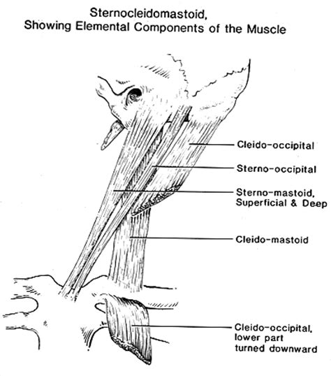 Image of sternocleidomastoid muscle