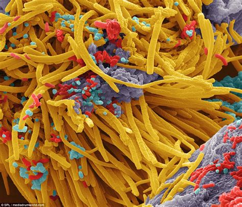 Close-up images of bacteria that live inside our mouths | Daily Mail Online