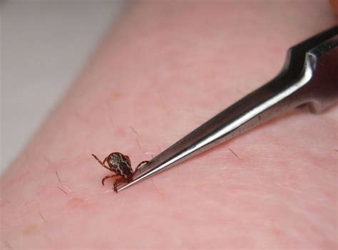 Ticks: The Plague Of Summer | The Forum Newsgroup