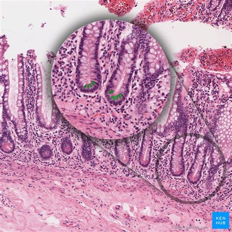 Types of cells in the human body: Histology | Kenhub