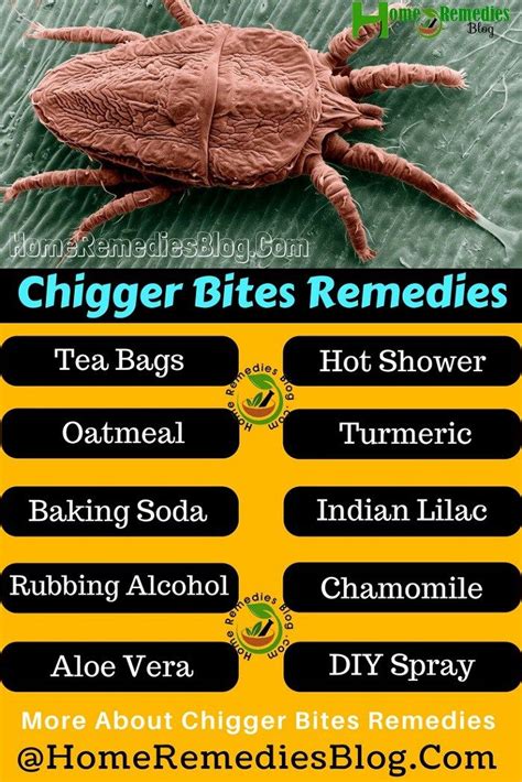 Chiggers And Nail Polish