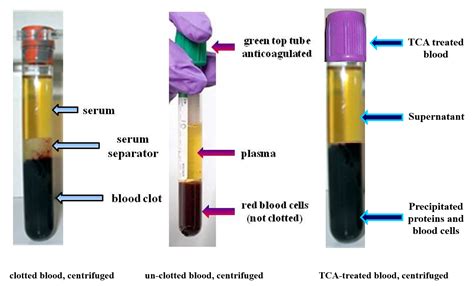 centrifuged-blood-samples - University Medical and Forensic Consultants