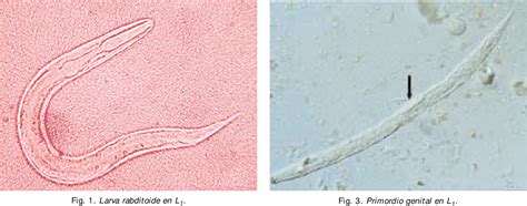 Strongyloides Stercoralis Larva Filariforme | SexiezPicz Web Porn