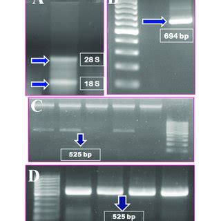 Agarose gel electrophoresis of total RNA isolated from in vitro... | Download Scientific Diagram