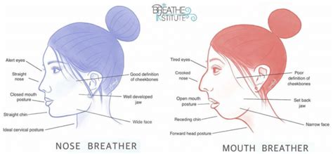 Your Appearance—Genetics vs. Breathing Total Care Dental and Wellness