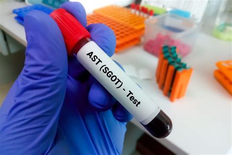 Understanding AST Blood Tests and Their Results - Facty Health