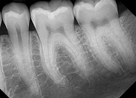 X-Ray Image Gallery - DentiMax