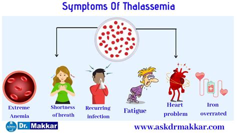 Thalassemia Signs And Symptoms