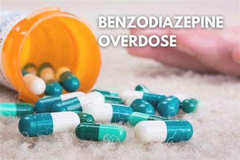 Can You Overdose on Benzodiazepines?