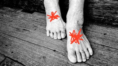 Midfoot arthritis: Symptoms, causes, and treatment