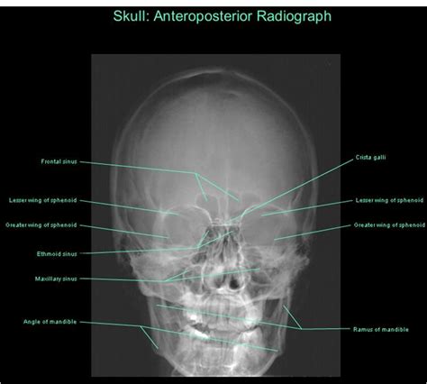 Medical radiography, Radiology student, Anatomy images