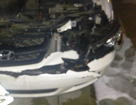 08 sonata front accident repair | Hyundai Forums