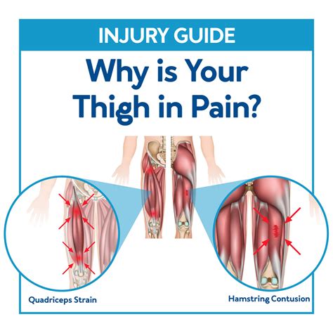 Why Is Your Thigh In Pain? | Carex