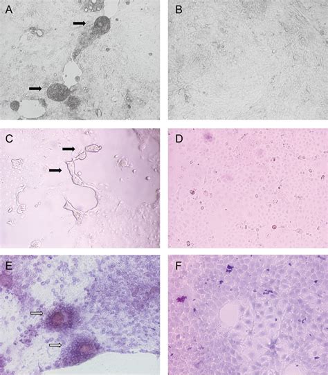 Cytopathic effects of cell rounding, detachment, and syncytia formation ...