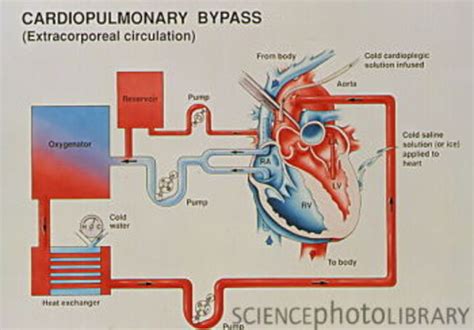 Heart Lung Machine Circuit Diagram