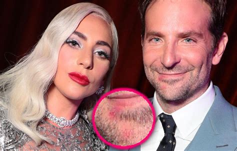 Lady Gaga's Lipstick Seen On Bradley Cooper's Mouth