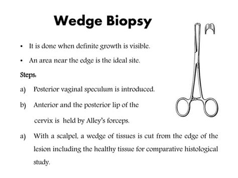 Cervical biopsy | PPT