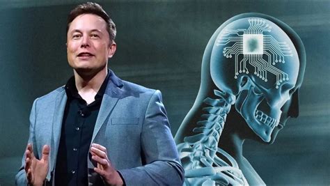 Breaking: Elon Musk’s Company Receives Approval for Human Brain Implant ...