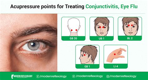 Acupressure Points for Treating Eye-Flu - Modern Reflexology