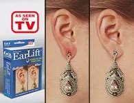 Does Ear Lifts Really Work?