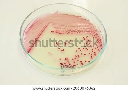 MORPHOLOGY-OF-SERRATIA-MARCESCENS Stock Photos and Images - Avopix.com