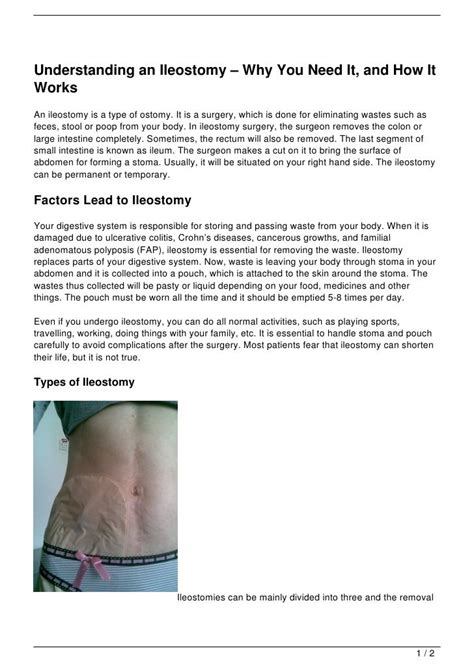 Understanding an Ileostomy – Why You Need It, and How It Works