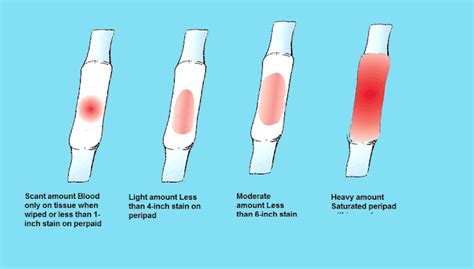 What Does Heavy Implantation Bleeding Look Like