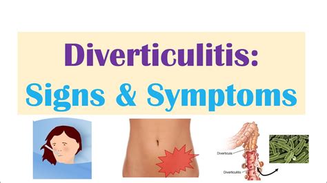 Everything you Need to Know About Diverticulitis - drharshsheth