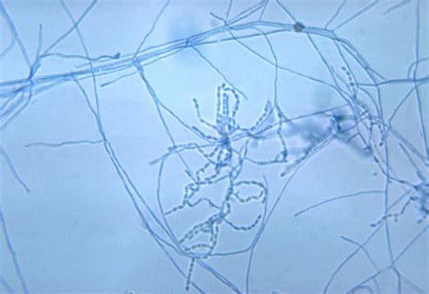 ACTINOMYCETES