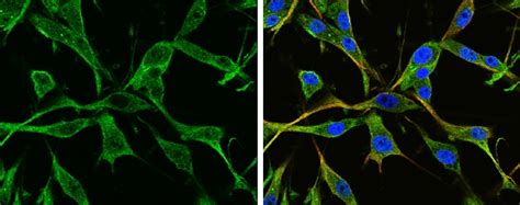 GFAP Antibody (PA5-85109)