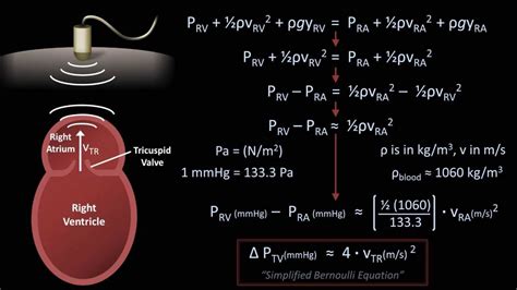 The Bernoulli Equation - Medical Applications (Fluid Mechanics - Lesson ...