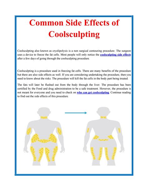 Common Side Effects of Coolsculpting by john Kenney - Issuu