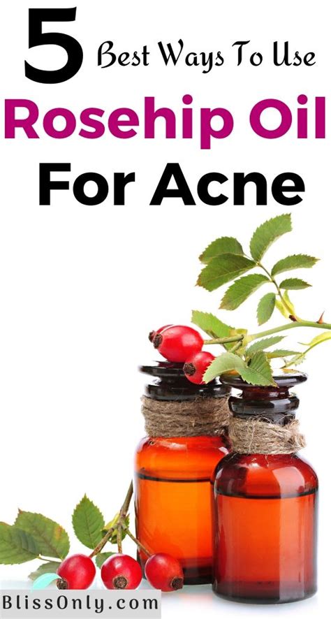 5 Best Ways To Use Rosehip Oil For Acne - BlissOnly