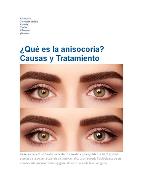 Causas, síntomas y tratamiento de la anisocoria y otras patologías oculares | PDF | Ojo humano ...