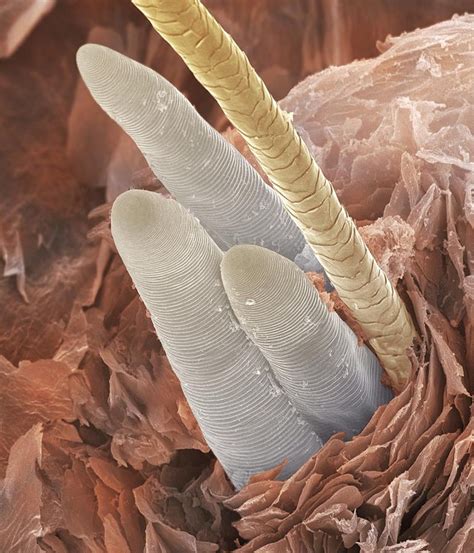 eyelash mites - Google Search | Microscopic photography, Micro photography, Things under a ...