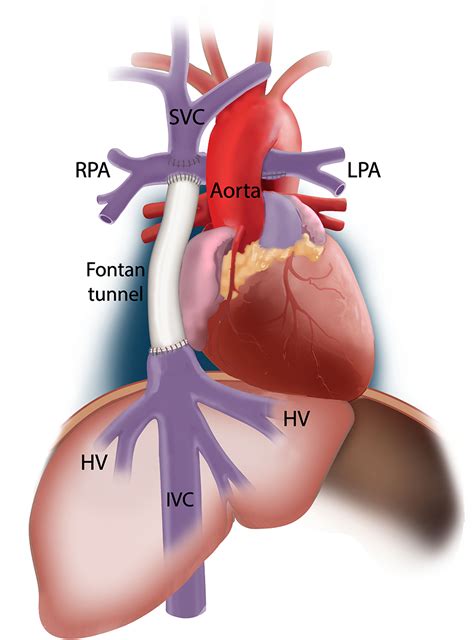 Frontiers | The Influence of Respiration on Blood Flow in the Fontan ...