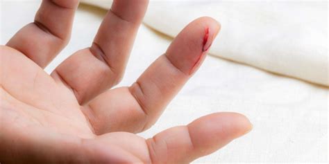 4 Most Common Workplace Injuries | Accident Treatment Centers
